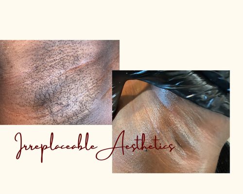Irreplaceable Aesthetics Bar