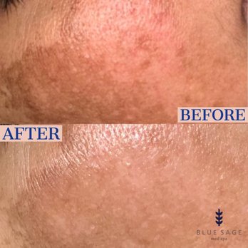 Blue Sage Med Spa - Skin Care Near Me - Amarillo, Texas