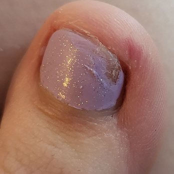 Red Carpet Salon - Big toe after I got home. Notice the horrid gap in between side of nail and skin - Nail Salons Near Me - Capitola, California