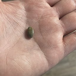 Stone