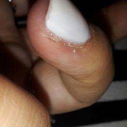 I have the biggest slice on my finger I have the biggest slice on my finger