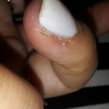Spafiesta Citi - I have the biggest slice on my finger - Nail Salons Near Me - New York, New York Spafiesta Citi - I have the biggest slice on my finger - Nail Salons Near Me - New York, New York