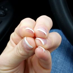 Un-even nail edges, left and right hands.