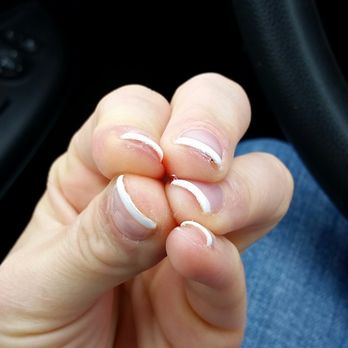 2Q Nails - Un-even nail edges, left and right hands. - Nail Salons Near Me - Ledyard, Connecticut