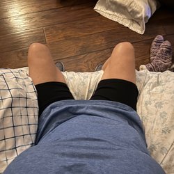 Jude LaBarbera, MD  - Mesa - View of abdomen after - drain still in