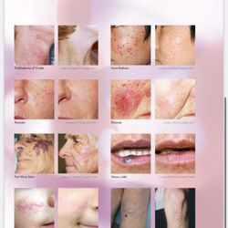 Shiny Laser Skin Clinic