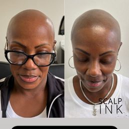 Before and after