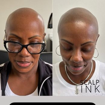 Scalp Ink LV - Before and after - Hair Loss Centers Near Me - Las Vegas, Nevada Scalp Ink LV - Before and after - Hair Loss Centers Near Me - Las Vegas, Nevada
