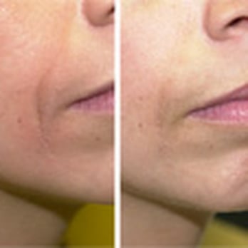 Michael Godin, MD - Cosmetic Surgeons Near Me - Richmond, Virginia Michael Godin, MD - Cosmetic Surgeons Near Me - Richmond, Virginia