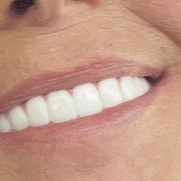 My healthy beautiful mouth. Thanks Dr Zurfluh My healthy beautiful mouth. Thanks Dr Zurfluh