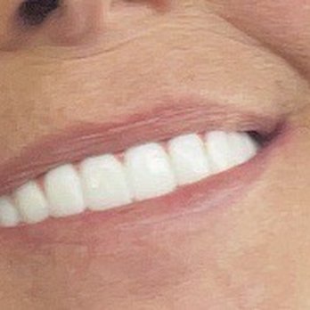 Pine Island Dental - My healthy beautiful mouth. Thanks Dr Zurfluh - General Dentistry Near Me - Davie, Florida Pine Island Dental - My healthy beautiful mouth. Thanks Dr Zurfluh - General Dentistry Near Me - Davie, Florida