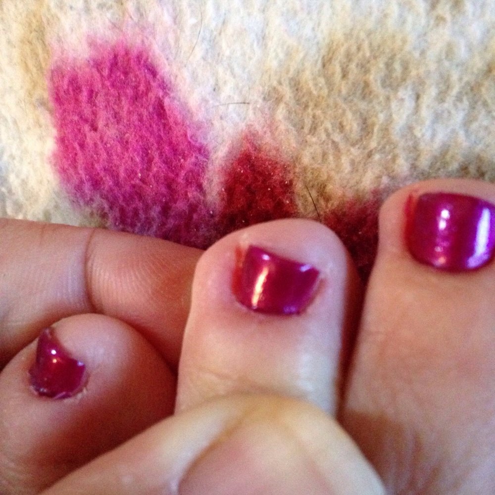TT Nails - Cuts and swelling on my middle toe - Nail Salons Near Me - Knightdale, North Carolina TT Nails - Cuts and swelling on my middle toe - Nail Salons Near Me - Knightdale, North Carolina