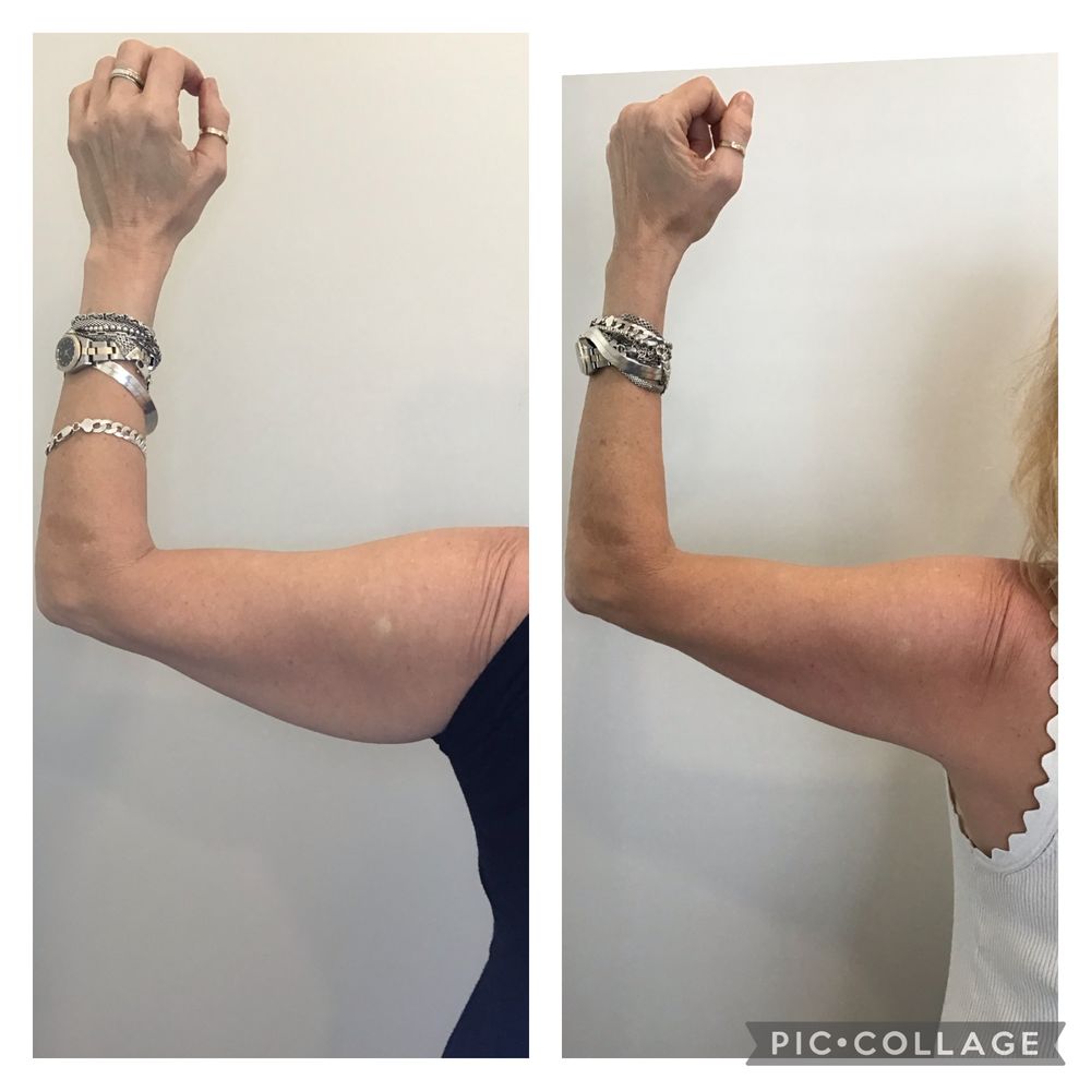 ULTRA BODY SCULPTING Updated September 2024 207 Photos & 114