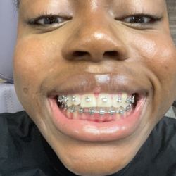 Smile Doctors Ortho - Fort Worth Western Center