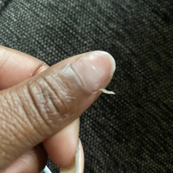 Wonder Nails - Severe hang nail as a result - Nail Salons Near Me - Washington, DC, District of Columbia