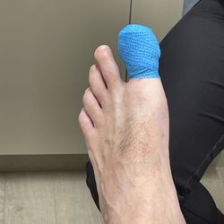 Barry University Foot and Ankle Institute- Tamarac Clinic - This is the only picture I can post that isn't gross.
