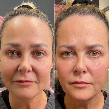 Bellissimo Aesthetics - Weight Loss Centers Near Me - Lithia, Florida Bellissimo Aesthetics - Weight Loss Centers Near Me - Lithia, Florida