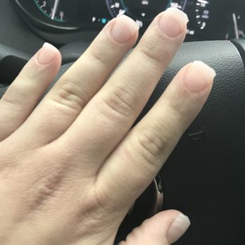 I Spa Nails - How my nails look after the man aggressively cut them off when I said I didn't like the way he was shaping my nails after he tried 4x - Nail Salons Near Me - Lansing, Michigan