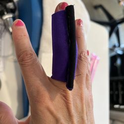 Lisa Savant Adams - Serial casting of a dislocated finger