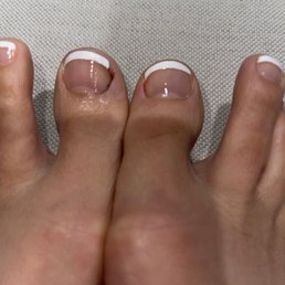Look at the chunk of nail that she cut off wrong on the left big toe