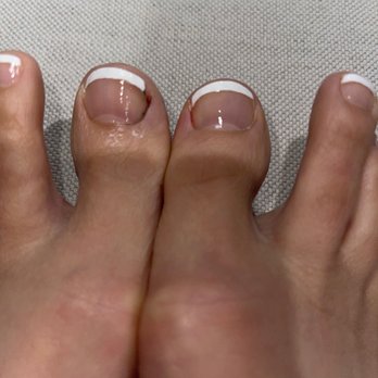 Lotus Beauty Salon - Look at the chunk of nail that she cut off wrong on the left big toe - Nail Salons Near Me - San Ramon, California