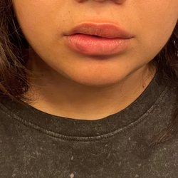 Terrible fillers