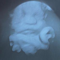 Unique Ultrasound - One of the pictures we got today!