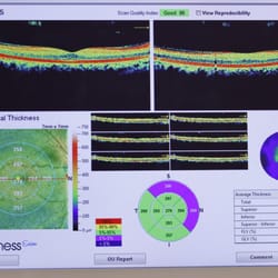 Sweetgrass Eyecare - The iWellness exam images the individual layers of the retina for early disease detection.