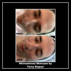 Skinsational Skincare