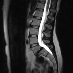 John C McElroy, MD - Lower Back Lumbar MRI