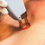 Advanced Permanent Hair Removal