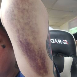 Garnet Health Medical Center - This was just the bruise on my arm they sent me home with Tylenol 325 mg. You need to actually help patients that sit for hours
