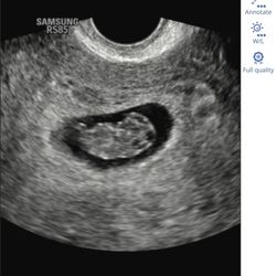 New Hope Fertility Center - My baby girl...