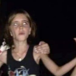 Richker Renee M D - This is what to many drugs does to kids.