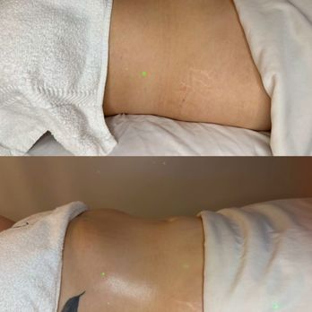 Up your Body Spa - Massage Therapy Near Me - Del Mar, California