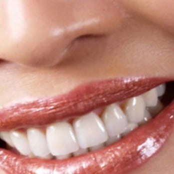 Alla Aver, DDS - Deerfield Dentist - Cosmetic Dentists Near Me - Glenview, Illinois