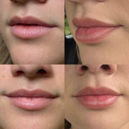 Before and after Before and after