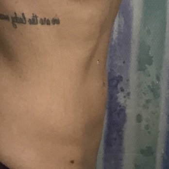 The Body Sculpting Studio - around 4 months after the procedure - it's gone! - Medical Spas Near Me - Valley Village, California