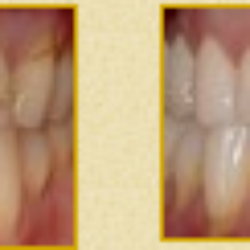 Gary B Shenfield, DDS - Before & After