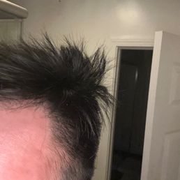 Hair Hair