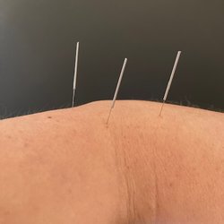 Roncesvalles Physiotherapy