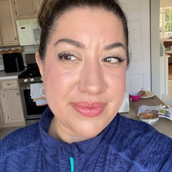 Glow Skin Studio - 1 weeks later. - Day Spas Near Me - Naperville, Illinois