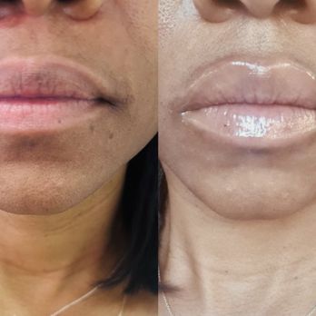 Fancy Aesthetics - Skin Care Near Me - Blackhawk, California