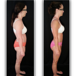 Total Body Connection - Before & After 10-Series of Structural Integration