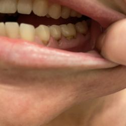 Asheville Dental Associates - Before