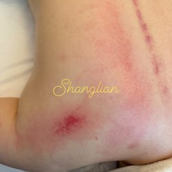 Shanglian Therapeutic Bodywork
