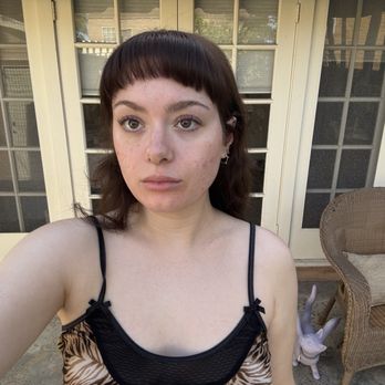 MoonGLO Aesthetics - my skin now - Skin Care Near Me - Fullerton , California