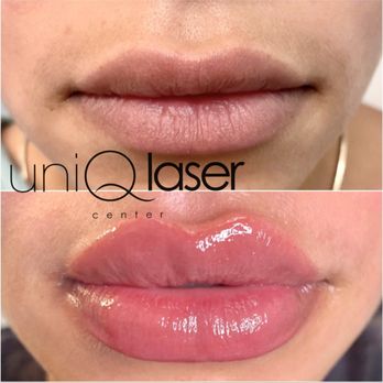 UniQ Laser Center - Skin Care Near Me - Watertown, Massachusetts UniQ Laser Center - Skin Care Near Me - Watertown, Massachusetts
