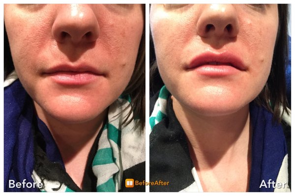 Jack And Jill Aesthetics 1010 Murfreesboro Rd Ste 190a Franklin Tn Mapquest