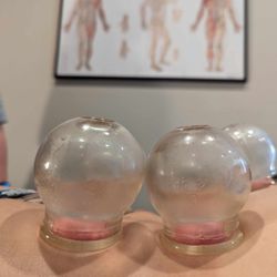 Acupuncture Elements - Cupping Therapy